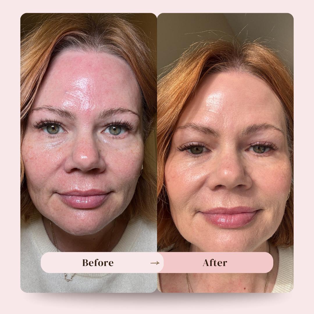 before-after